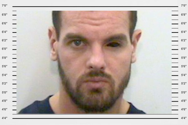 25. SOMEONE GIVE HIM HIS EYE. PLEASE.