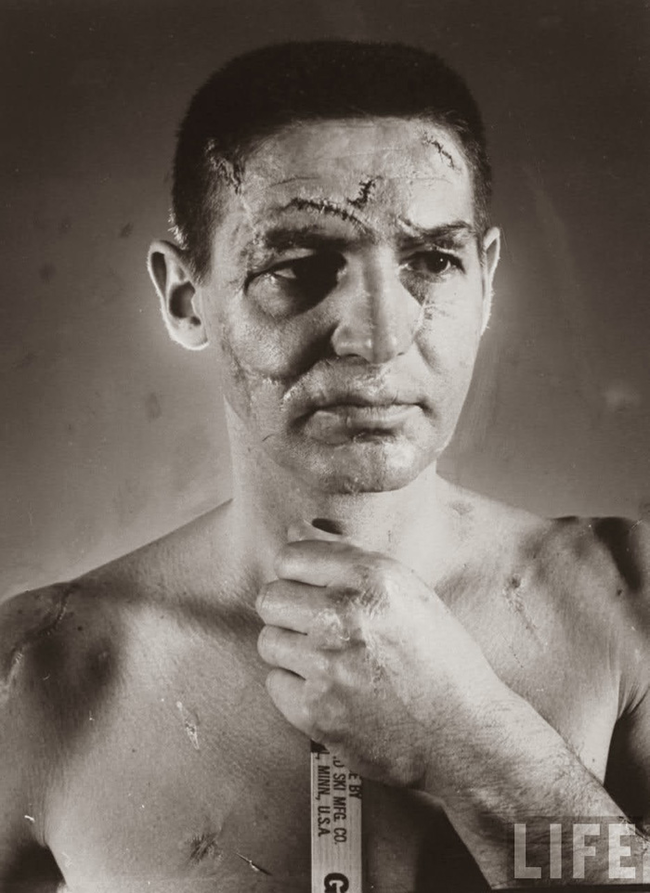 Portrait of hockey goalie Terry Sawchuk before face masks became standard in 1966.