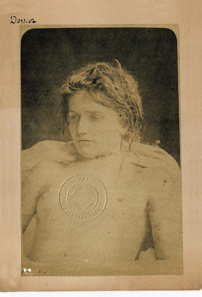 This was taken from the autopsy of murder victim Cl&eacute;mentine Pichon. Notice the seal of the French police on the document.