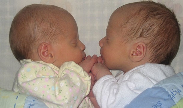 Twins Separated at Birth Who Had Incredibly Similar Lives