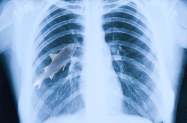 In India, it's apparently a popular game to swallow live fish. One time a boy accidently inhaled the fish instead, and doctors had to surgically remove it from his lungs.