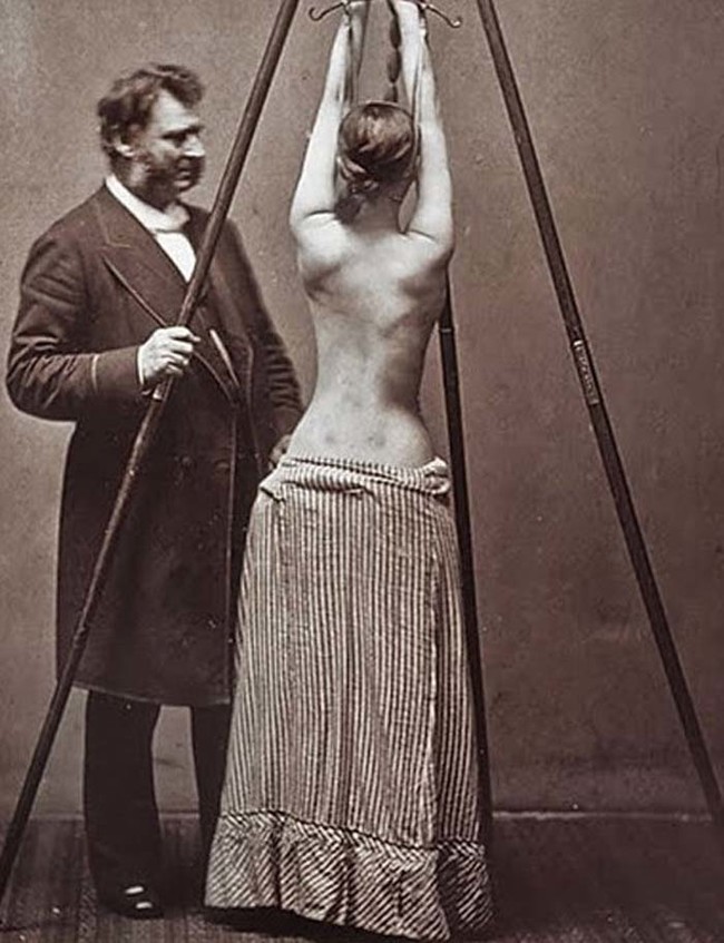 This isn't a scene from 50 Shades Of Grey --- it's actually how they used to treat scoliosis.