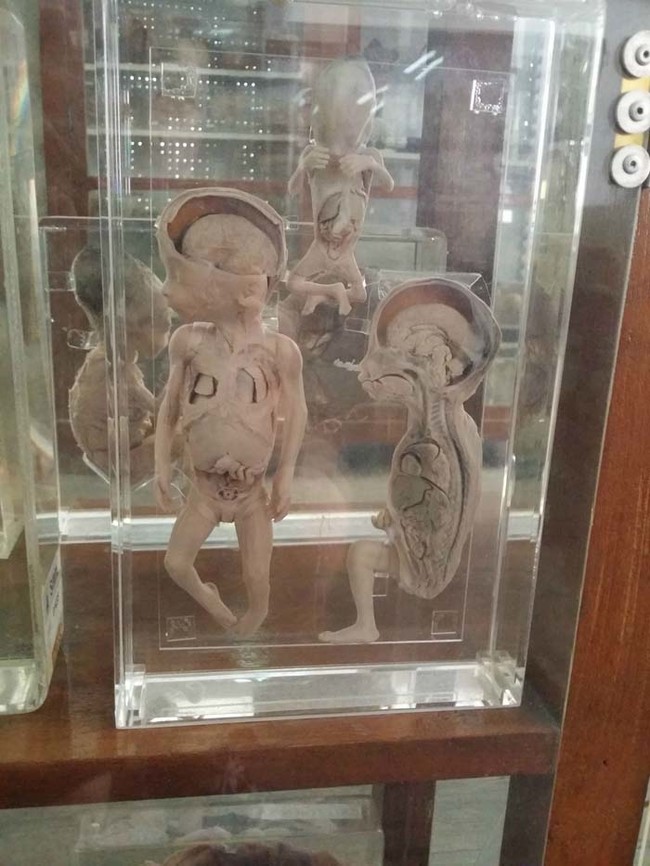 A cross section of a human infant.