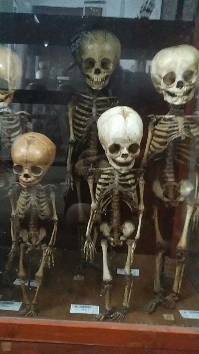 Children's skeletons.