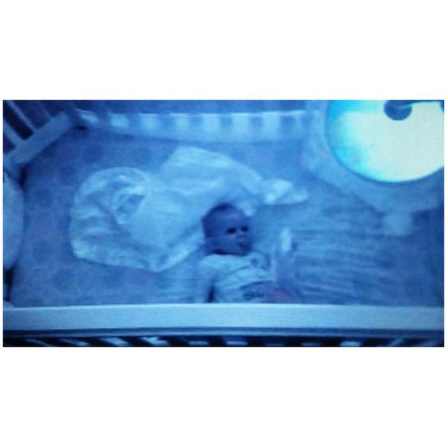 How did the baby get flipped around like that?