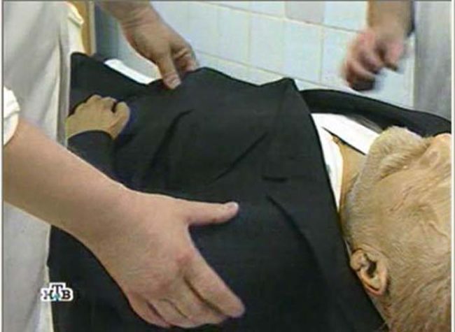 That's because most of what can be seen is plastic and not actual flesh.