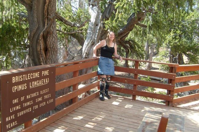 Throughout her life, the woman has turned to self-harm in an attempt to become disabled. These days, the research scientist relies on leg braces and a wheelchair to make her feel more comfortable in her body.