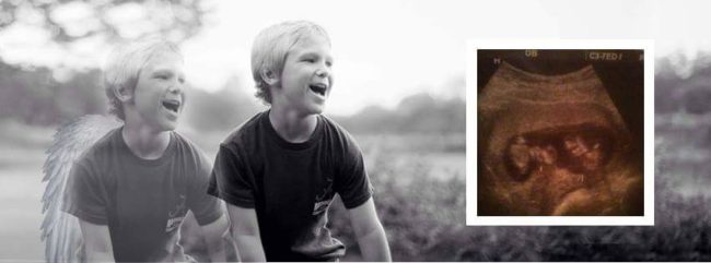 Brooke and Michael are trying to raise awareness about TTTS in the hopes that more babies can be saved.They've already held two fundraisers in the form of walks for the TTTS Foundation, and the third walk is scheduled for March 5.