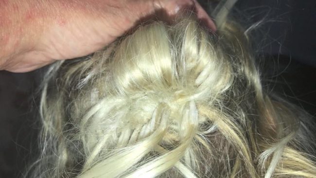 Ultimately, she says it's ruined her confidence and now wears a wig when she leaves the house, which isn't very often due to the state of her hair.