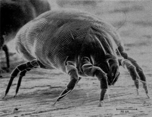 Dust mites could be living and pooping in your bed right now.They especially love eating flakes of human skin.