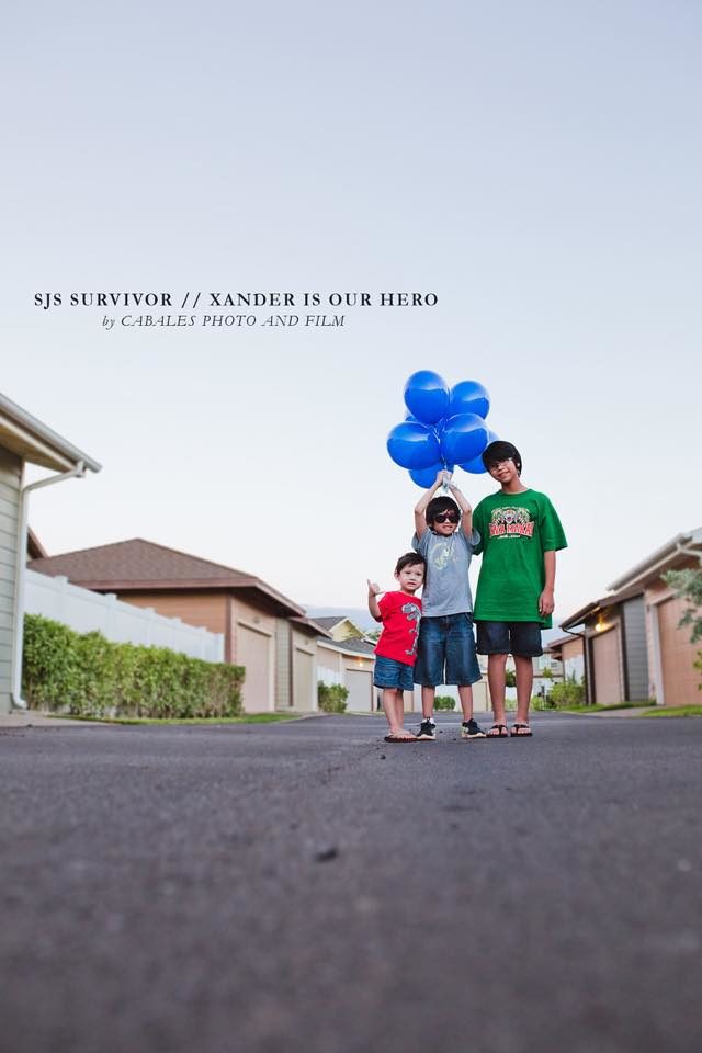 Xander also can't produce saliva anymore, can't cough or clear any mucus, and has to use a nebulizer multiple times a day because of the damage to his lungs.