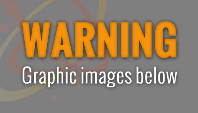 A word of warning: the footage is difficult to watch.