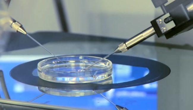 Unfortunately, mitochondrial disease primarily affects children.About one in 4,300 children with it are born every year, and there is no cure -- but that's what makes this treatment so significant.Mitochondrial DNA is only inherited through the mother's eggs, so replacing it with healthy samples could prevent the disease altogether and save lives.