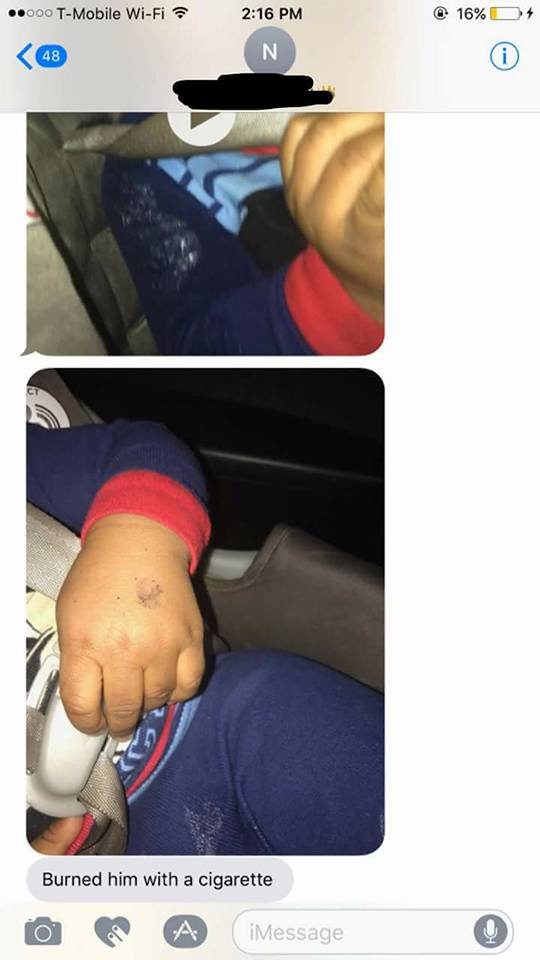 The final image shows ashes on his hand where Peterkin claims to have burned him with a cigarette.