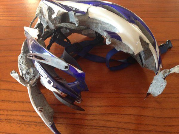 "The helmet of our patient after a bicycle crash (into a wall at 80km per hour)!"