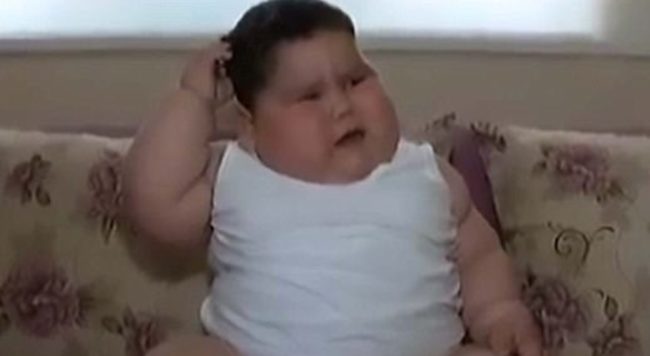 Yagiz was born with a leptin deficiency. Leptin is the hormone in the body that regulates metabolism and weight. 