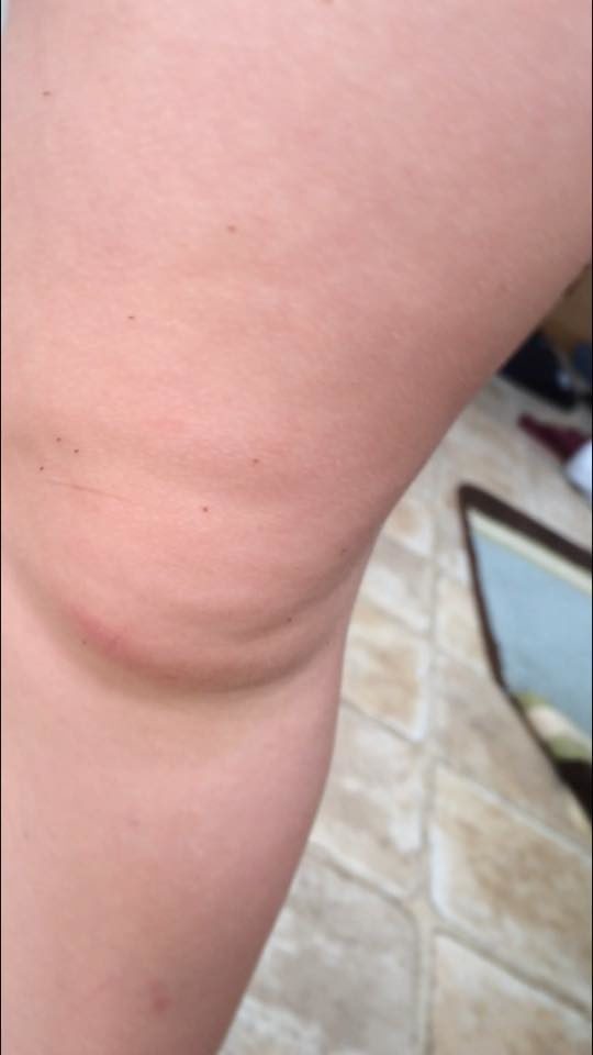 The worst part is that they tend to show up in massive groups.