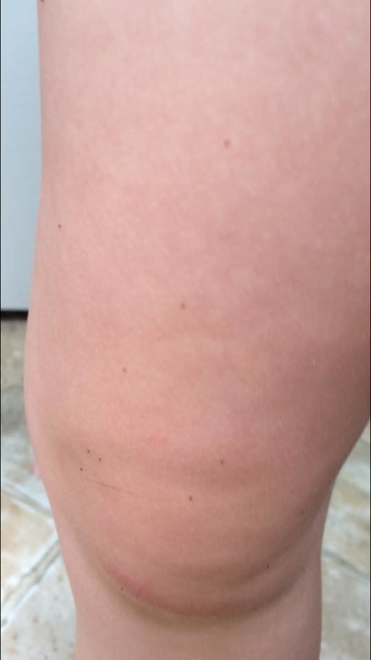 That's when she tried brushing the specks off. Oddly, they wouldn't budge.