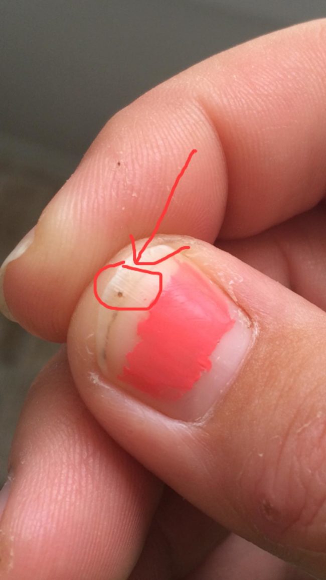 Seed ticks are the larval form of adult ticks and they attach themselves to hosts just like their mature counterparts.