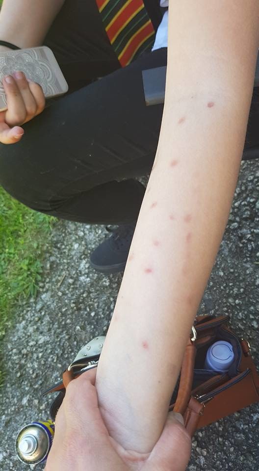 Children all across England are filming themselves holding the deodorant cans close to their skin for as long as possible.