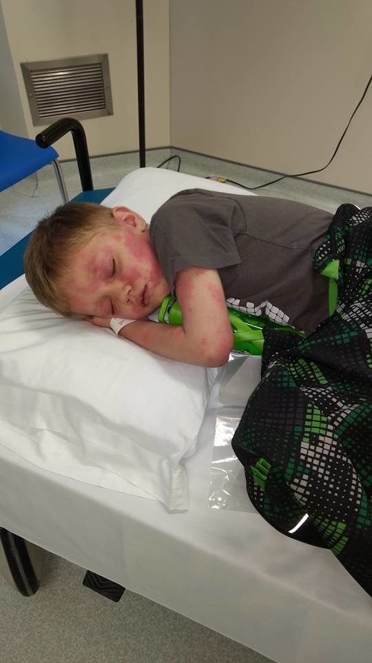 At that point, she'd had enough and refused to leave. She demanded to see a pediatrician, who finally decided to run a measles test to be safe. 