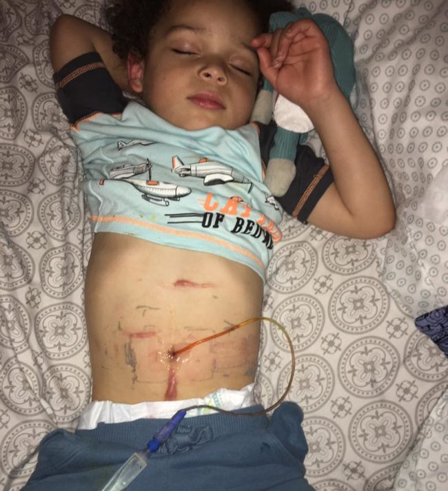 While waiting to check out, an older woman took notice of the stomas and bluntly asked Lynn &ldquo;why in the world would you let someone do that to him?&rdquo;