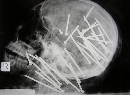 Um, was this guy even still ALIVE!?!