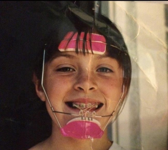 Ugh. Headgear's the worst.