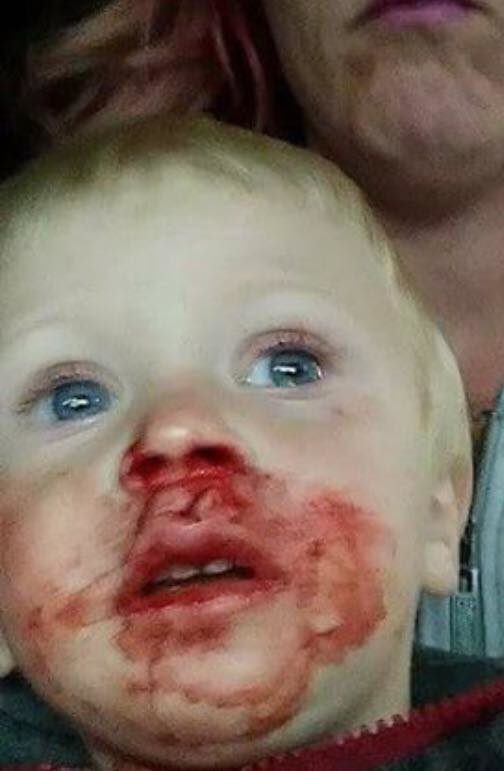 The startling photos show Natas with a bloody face...