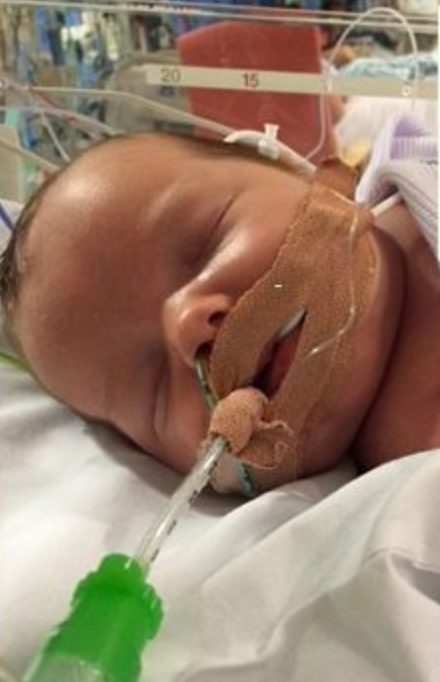 Once at the hospital, doctors made the horrifying realization that the little one would have to be put into a medically induced coma.