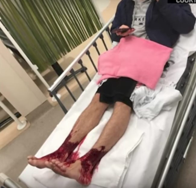 Doctors and nurses were perplexed by the creatures that bit him, concluding they may be some form of sea lice. 