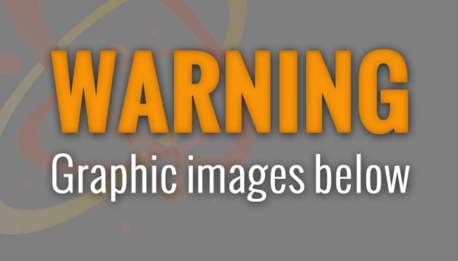 The images below are quite graphic.