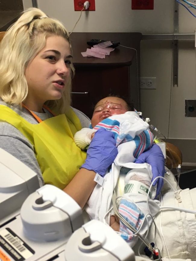 When she arrived at the local hospital, she discovered that her baby boy, Maddox, had second and third-degree burns covering 45 percent of his body.
