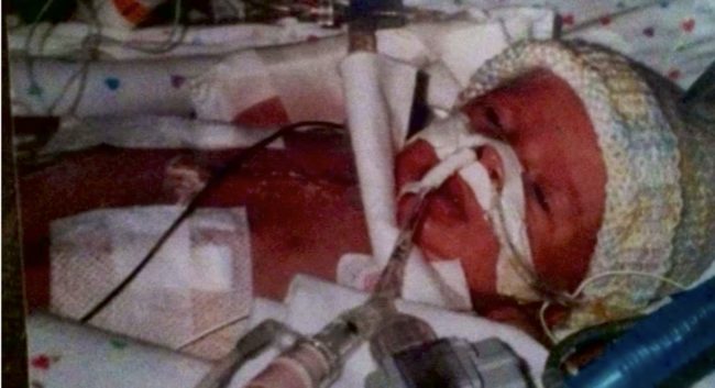 Peyton had a history of heart problems. He was diagnosed with hypoplastic left heart syndrome not long after his birth in 2003.