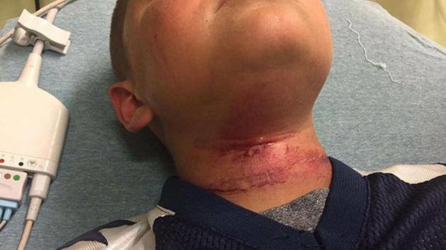 "One boy said, 'Let's do this,' and then pushed him off the picnic table and hung him," Slattery said. She also said he swung from his neck three times before he could free himself.