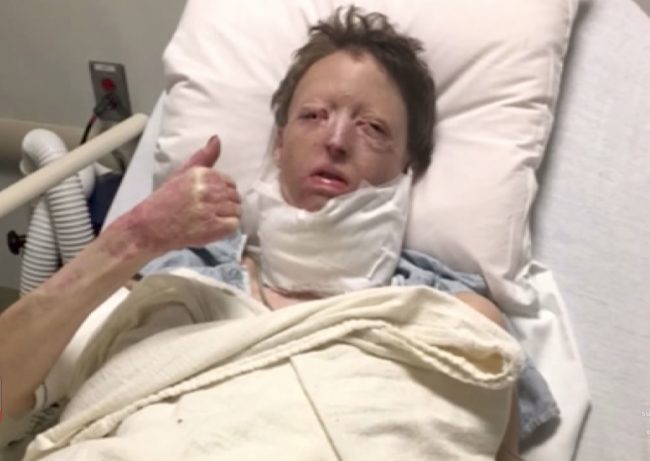 After 20 surgeries and almost $2 million in medical bills, Courtney was dealt another devastating blow when Mitch made the decision to leave her.