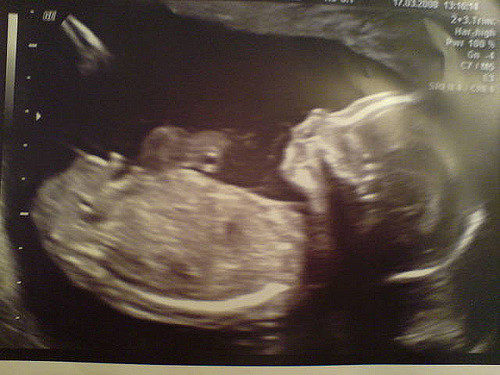 If you notice decrease in movement or feel chest pains -- which can be the result of reduced fetal movement -- it's important to call or visit your doctor because it may be an indication of something wrong.