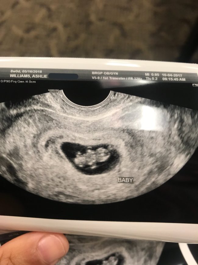 Recently Williams discovered that their tiny family was about to grow by one more, serving as the perfect opportunity for Dad to have his redemption!