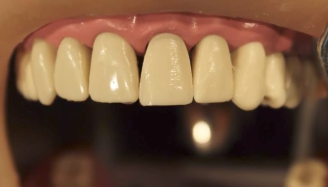 These procedures are typically carried out over two appointments.