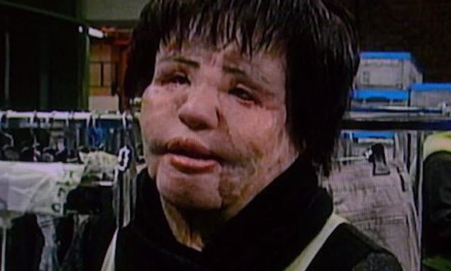 Though it's sadly not possible, the now 57-year-old just wishes she could have her old face back.