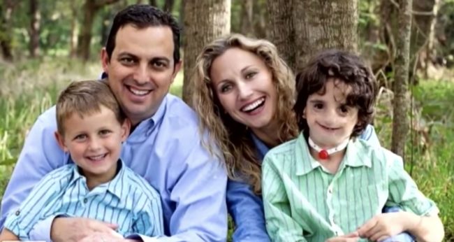 Affected individuals will oftentimes have severely underdeveloped facial bones, especially in the cheeks, jaw, and chin. Some people with the condition are also born with a cleft palate.