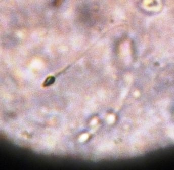 The basis of the contraceptive gel is hormones progestin and testosterone. The progestin works to stop the man's testes from producing enough testosterone to produce sperm. The added testosterone is then used as an alternative way to acquire the hormone without producing a hormonal imbalance.