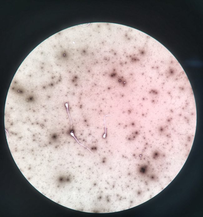 Theoretically, if applied according to researcher's recommendations, the contraceptive gel should help suppress sperm levels for up to 72 hours.