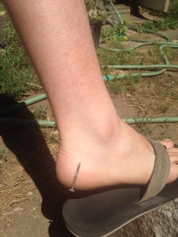 It barely broke the skin.